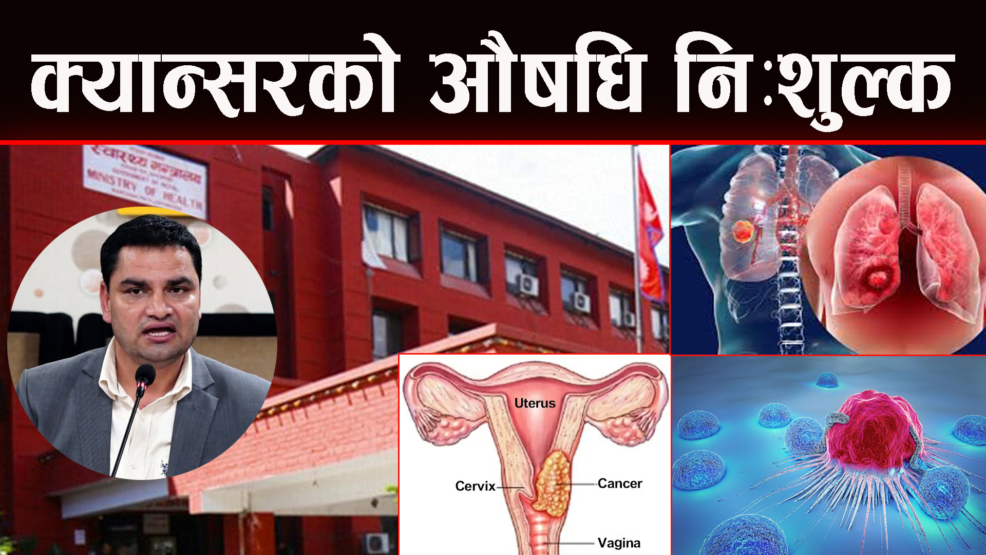 अब सरकारले क्यान्सर रोगको किमो औषधि निःशुल्क दिने
